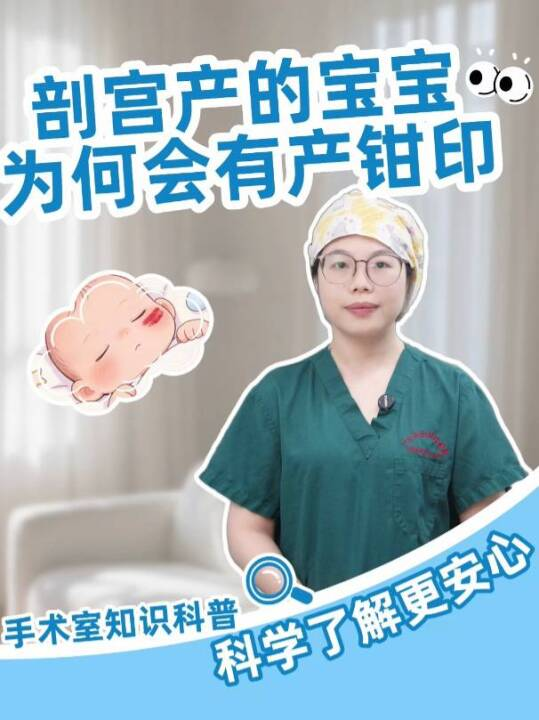 剖宫产的宝宝为何会有产钳印？